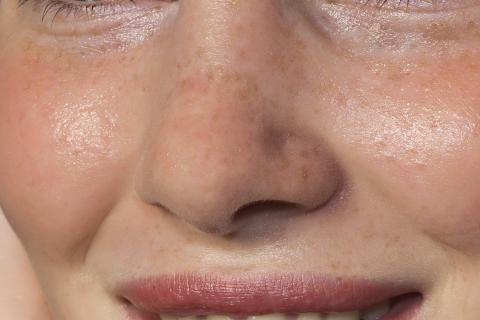 Nose. The Bengali for "nose" is "নাক". Nose. The Bengali for "nose" is "নাক".