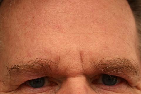 Forehead. The French for "forehead" is "front". Forehead. The French for "forehead" is "front".