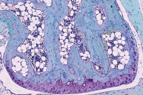 Cartilage. The French for "cartilage" is "cartilage".