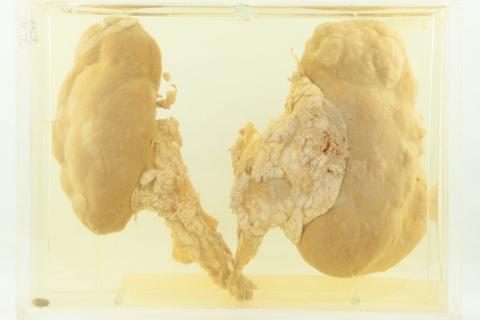 Kidney. The German for "kidney" is "Niere".