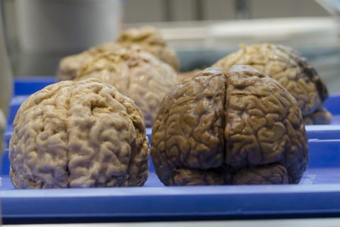 Brain. The Greek for "brain" is "εγκέφαλος".