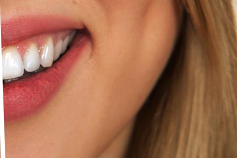 White teeth. The Thai for "white teeth" is "ฟันขาว".