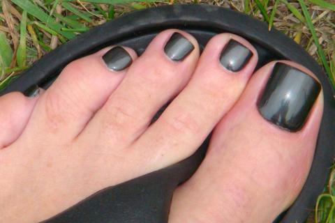 Black toenails. The Thai for "black toenails" is "เล็บเท้าสีดำ".